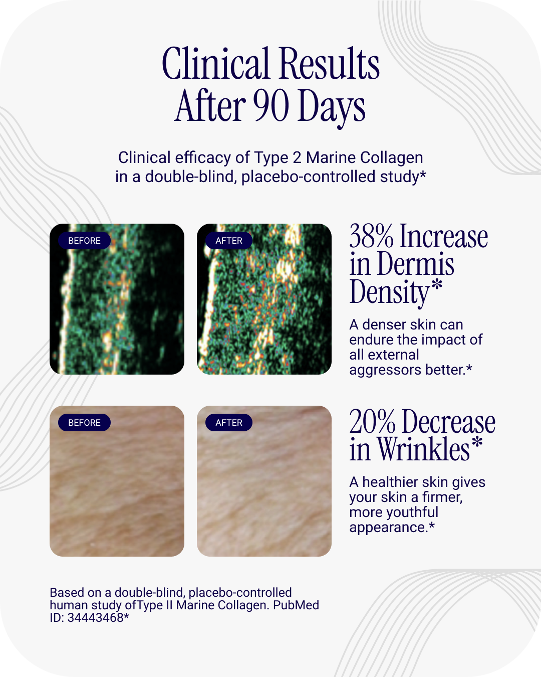 Liposomal Collagen Peptides